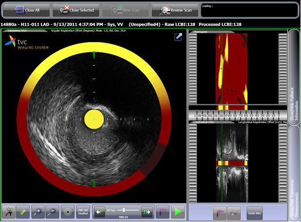 Ultrasound system / on platform / for intravascular ultrasound imaging TVC Imaging System™ Infraredx Ultrasound system / on platform / for intravascular ultrasound imaging TVC Imaging System™ Infraredx
