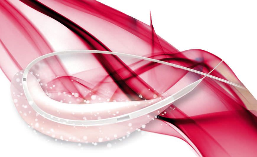 Dilatation catheter / coronary / drug eluting / balloon Restore DEB® Cardionovum Dilatation catheter / coronary / drug eluting / balloon Restore DEB® Cardionovum