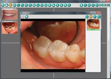 dexis platinum sensor holders dental