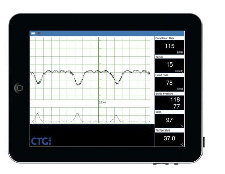 Heart rate simulator / fetal CTGi iSimulate Heart rate simulator / fetal CTGi iSimulate
