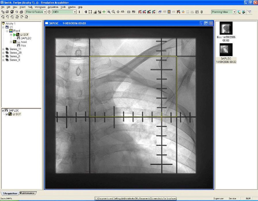 Varian Medical Systems International AG