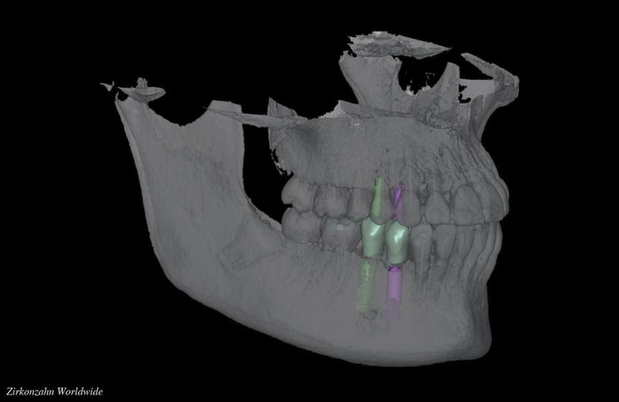 Health Management and Leadership Portal Intraoral scanbody