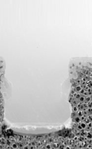 Health Management and Leadership Portal | Patella prosthesis Zimmer ...