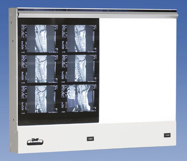 Health Management and Leadership Portal White light Xray film viewer