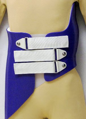 Health Management and Leadership Portal | Cervico-thoraco-lumbo-sacral ( CTLSO) support corset / scoliosis Milwaukee Spinal Technology |  HealthManagement.org