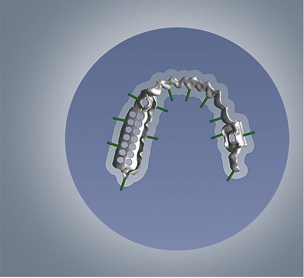 CAM software / dental Yenadent Cam 5.0 Yenadent CAM software / dental Yenadent Cam 5.0 Yenadent