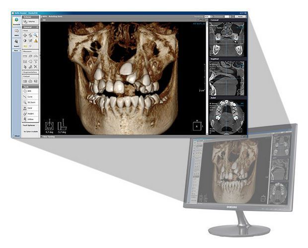 Health Management and Leadership Portal Analysis software / 3D