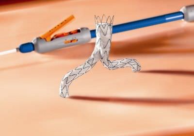 Abdominal stent graft E®-VITA Jotec Abdominal stent graft E®-VITA Jotec