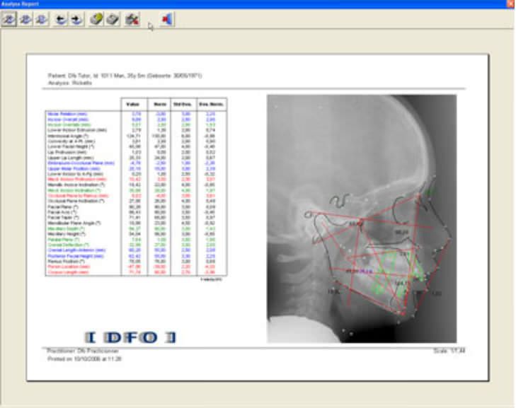 Cephalometric analysis software / medical Mediadent DFO IMAGELEVEL Cephalometric analysis software / medical Mediadent DFO IMAGELEVEL