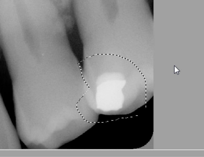 Dental implant simulation software / medical Mediadent v6 IMAGELEVEL Dental implant simulation software / medical Mediadent v6 IMAGELEVEL