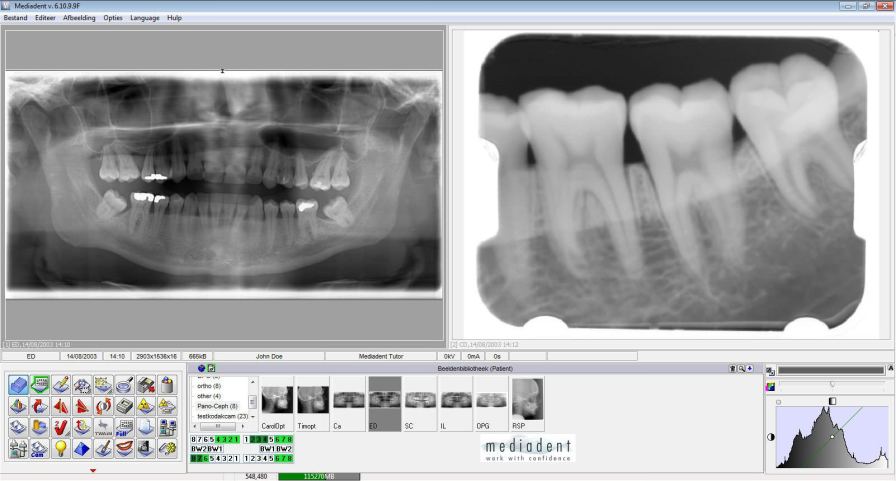 Приложение рентген. Программа Mediadent data. По CLINIVIEW. CLINIVIEW инструкция как сделать снимок.