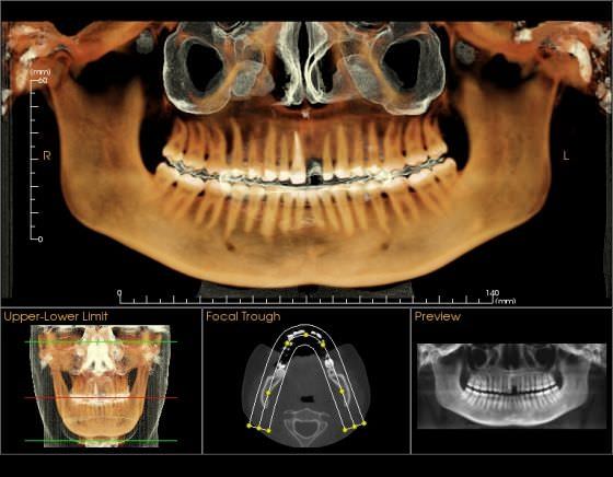 Medical software / for dental imaging Tx STUDIO™ Imaging Sciences International Medical software / for dental imaging Tx STUDIO™ Imaging Sciences International