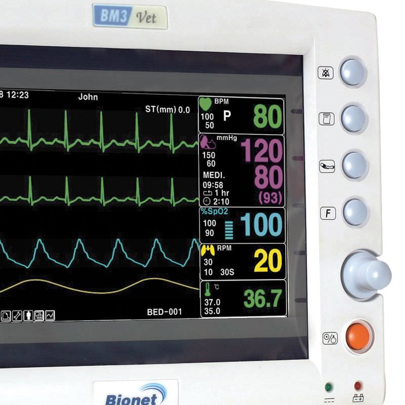Монитор пациента сторм. Прикроватный монитор bm3 Bionet. Монитор пациента bm3. Монитор пациента bm3 wide. Монитор пациента Bionet BM 5.