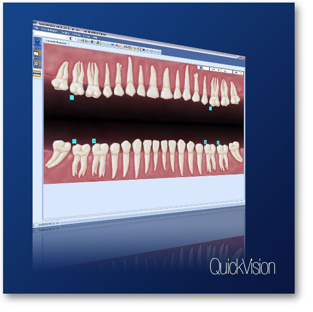 Diagnostic software / control / import / for dental imaging Quickvision OWANDY Diagnostic software / control / import / for dental imaging Quickvision OWANDY