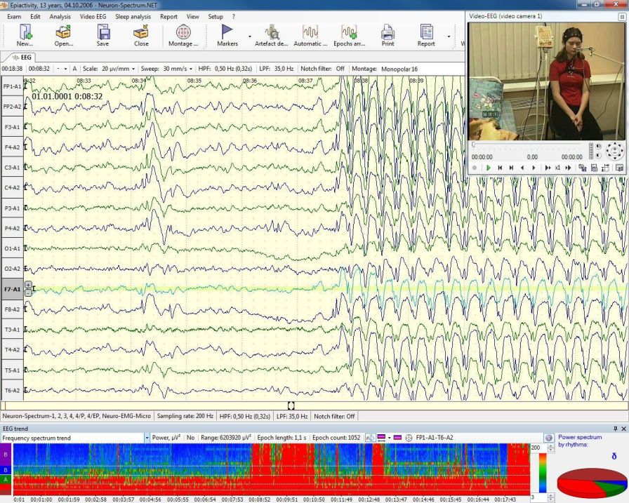 Health Management and Leadership Portal EEG monitoring system Neuron