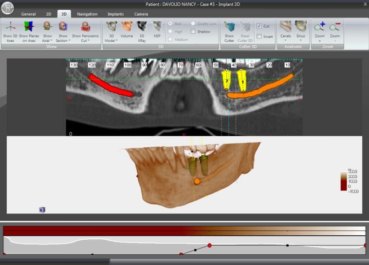 Health Management and Leadership Portal Dental implant simulation