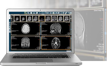 imagecast software for healthcare imagecast software for healthcare