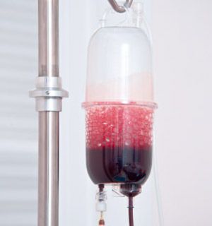 Autohemotherapy infusion set Sangiset® Humares GmbH Autohemotherapy infusion set Sangiset® Humares GmbH