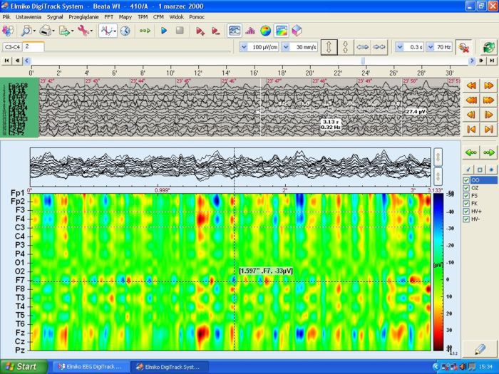 Health Management and Leadership Portal EEG mapping system EEG
