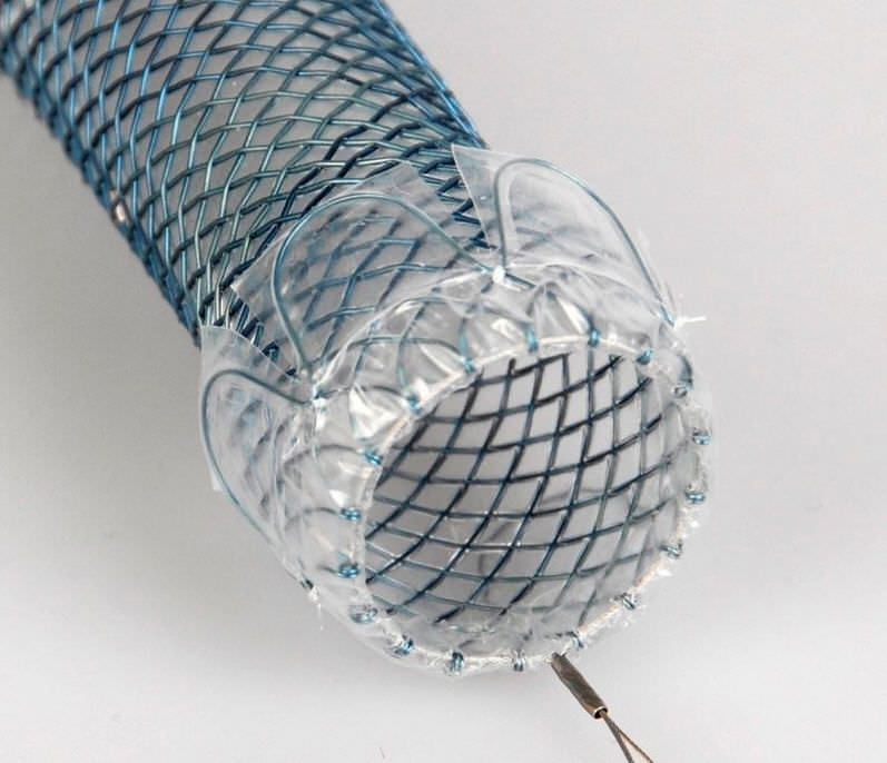 Esophageal stent / nitinol HV - HV Plus ELLA-CS Esophageal stent / nitinol HV - HV Plus ELLA-CS