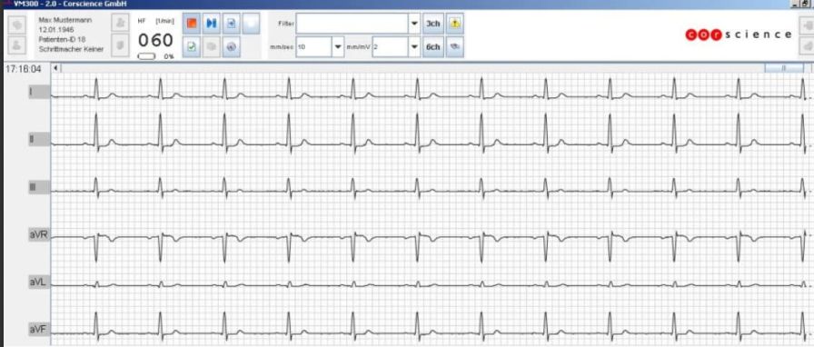 Medical software / electrocardiography VM300 Corscience Medical software / electrocardiography VM300 Corscience