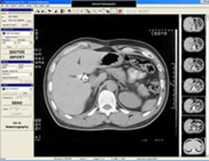 DICOM converter software / medical ClinicalExpress® DICOM 3D Systems GmbH DICOM converter software / medical ClinicalExpress® DICOM 3D Systems GmbH