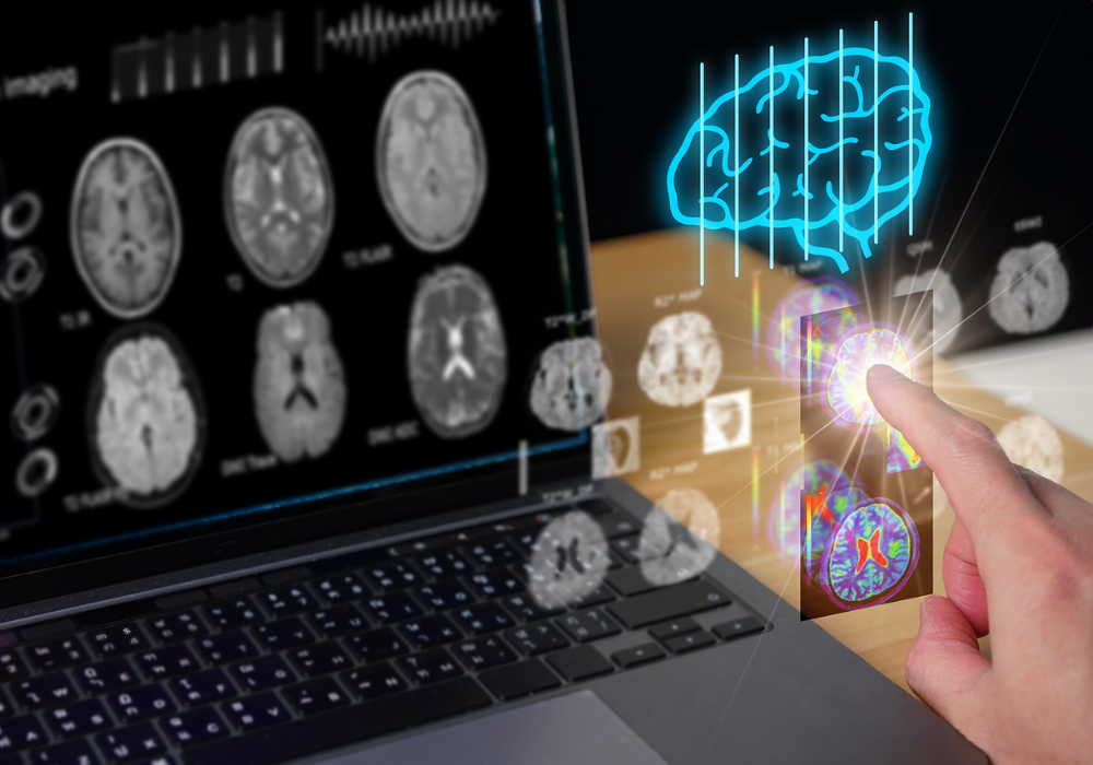 AI-assisted brain MRI interface, supporting neuroradiology, stroke assessment, diagnostic imaging and clinical decision-making.
