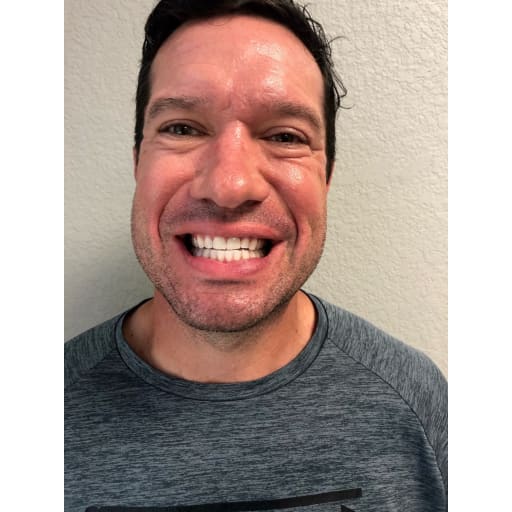 After photo of Travis C. - Teeth Whitening