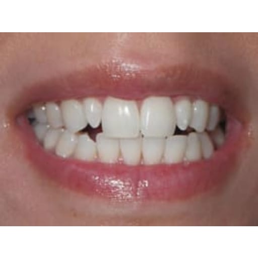 Plantation Dental Care is your dental care provider in Plantation