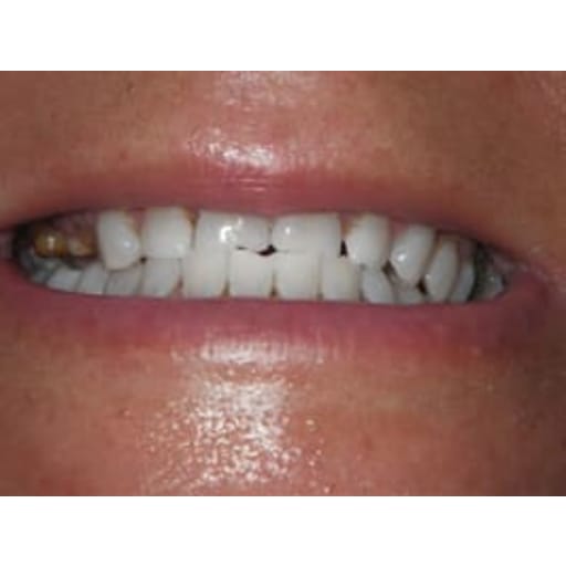 Plantation Dental Care is your dental care provider in Plantation