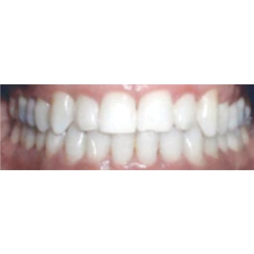 Plantation Dental Care is your dental care provider in Plantation