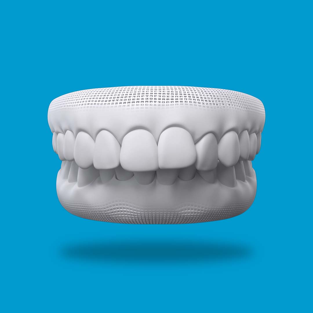 Overbite/Underbite