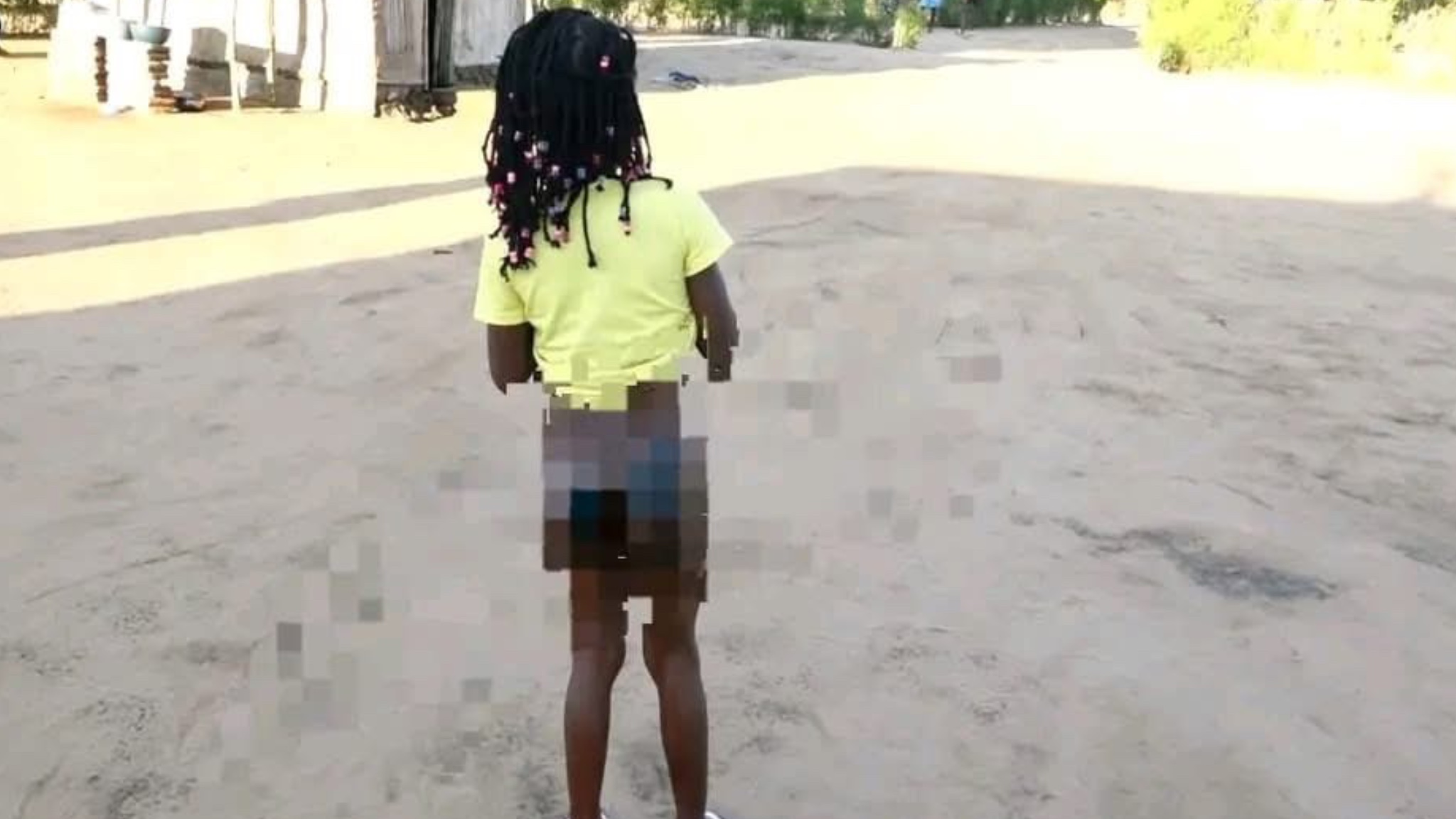 Mãe acusada de queimar filha com ferro de engomar por alegado roubo de cinco meticais