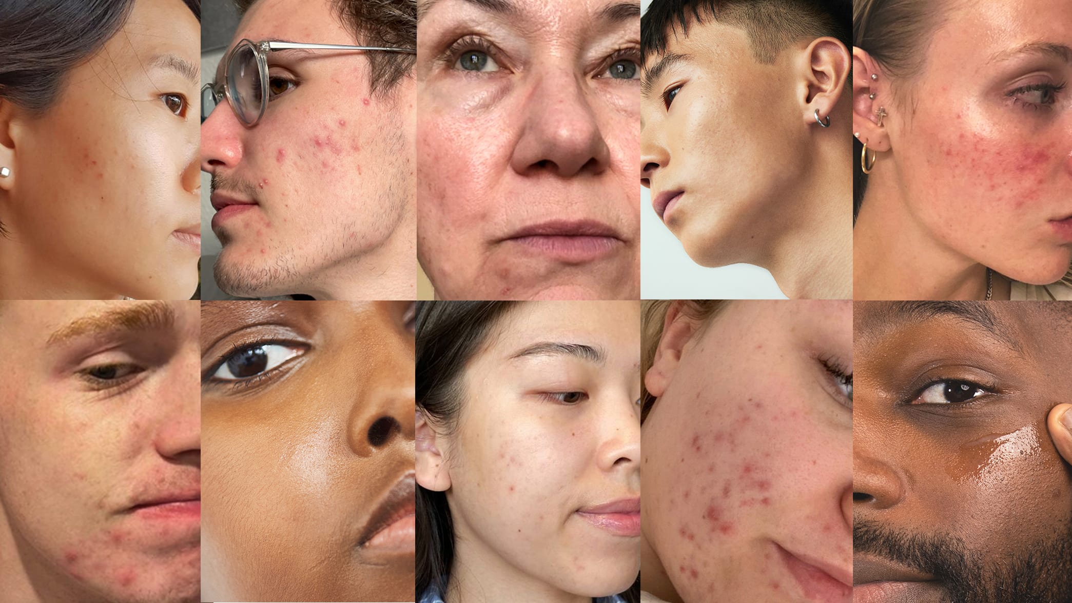 Your guide to the most common skin concerns - NØIE - NØIE