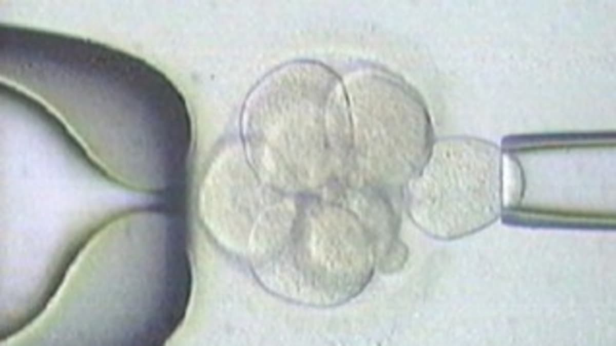 Co je preimplantační genetická diagnostika?