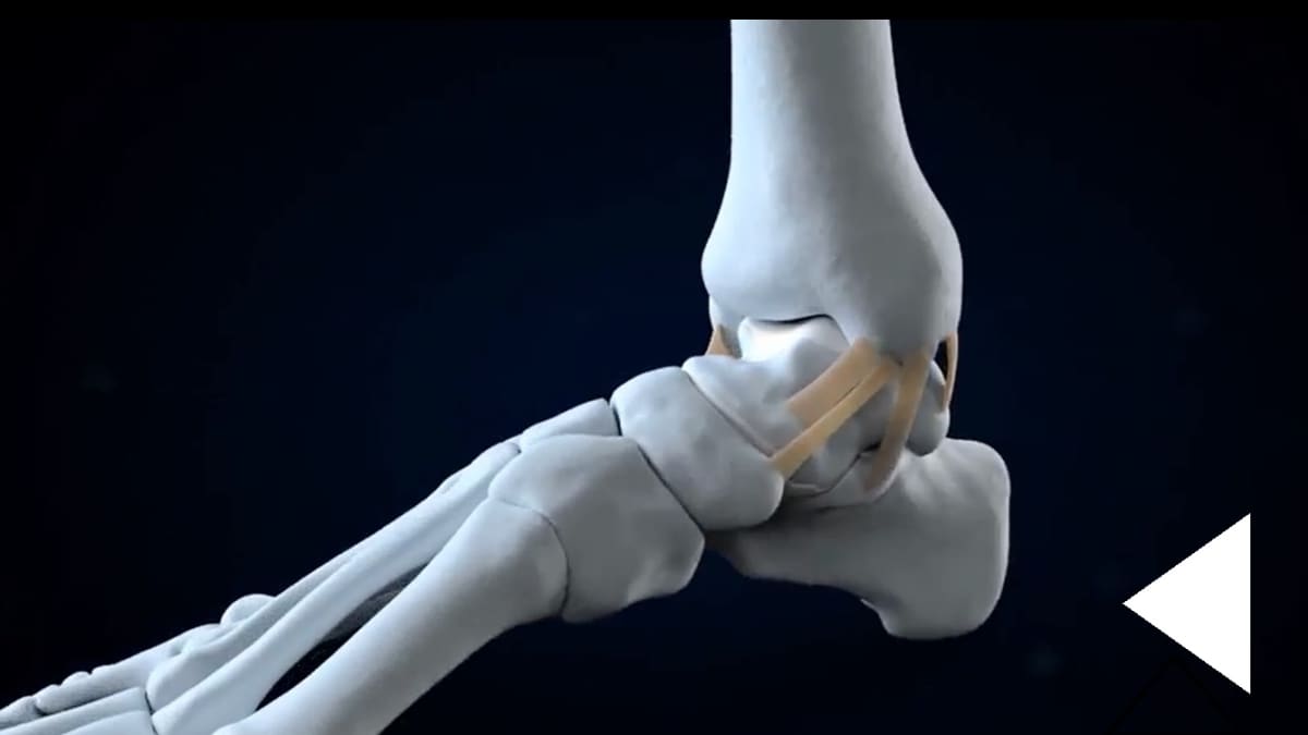 Funkce kloubů při hemofilii - kotník