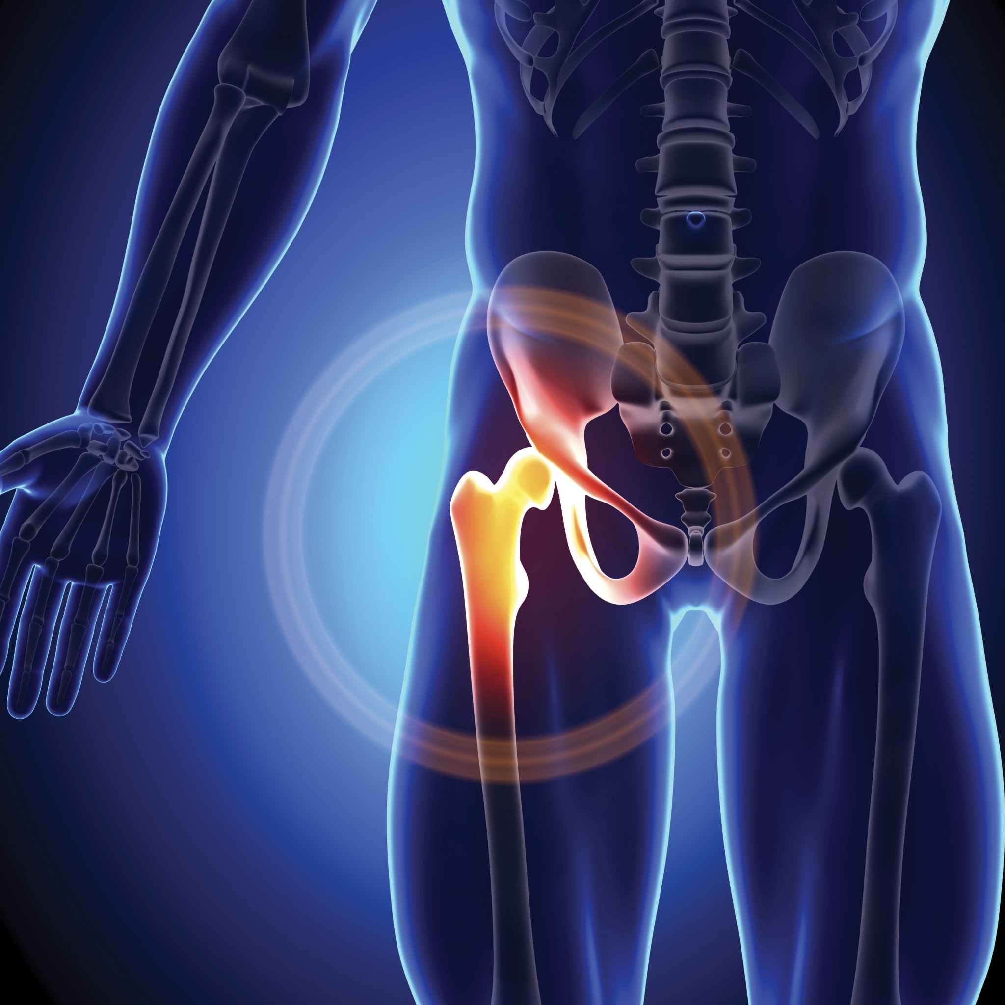 Advantages Of Anterior Hip Replacement Heywood Hospital 