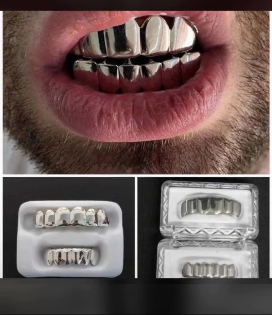 Full set Teeth grillz — Accessories — Rose Fashion