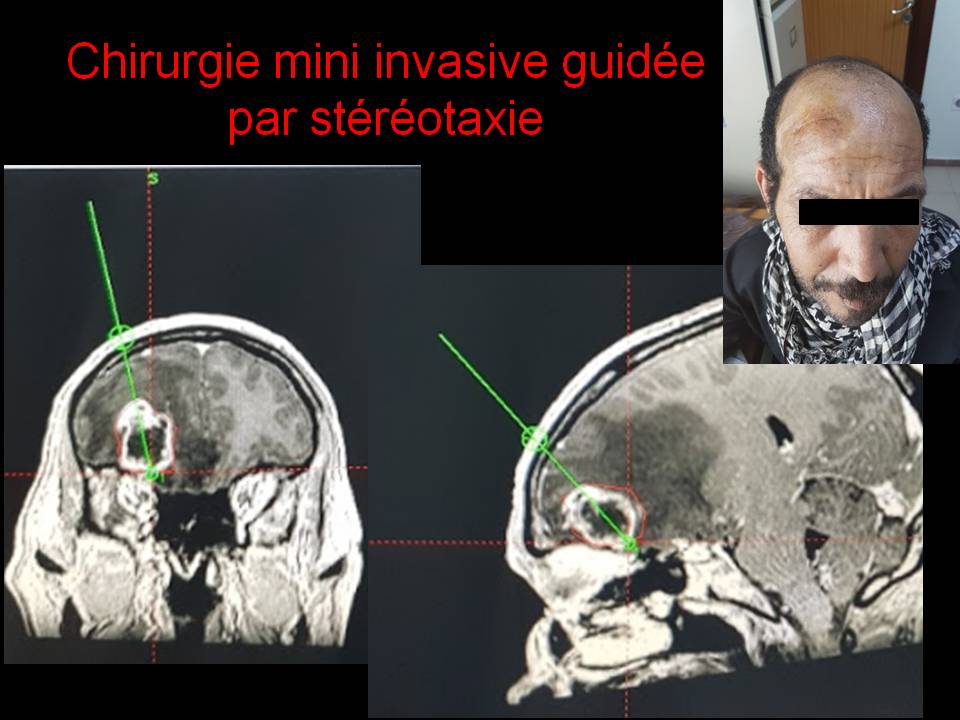Pr Adyl Melhaoui