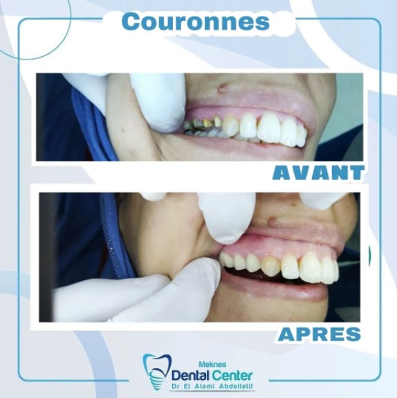 Dr Abdellatif El Alami