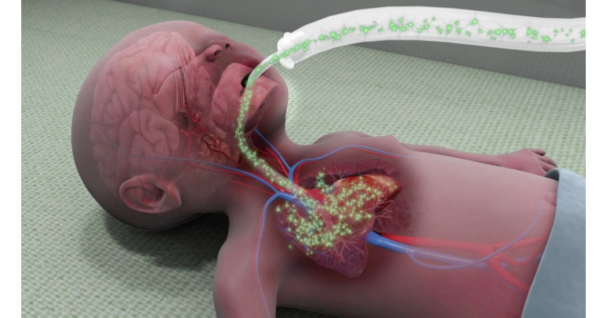 Premature Fetus Lung Prematurity High Impact® Visual