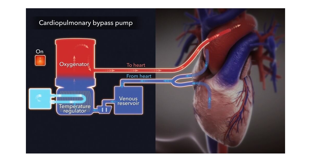 cash cardio and pulmonart pdf cash cardio and pulmonart pdf