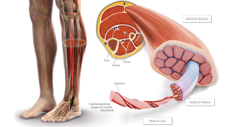 400k Settlement Exposing Negligence After Doctor Denies Cutting Peroneal Nerve High Impact Visual Litigation Strategies Peroneal nerve injury and disease may arise due to various possible causes ranging from trauma, compression or infection. 400k settlement exposing negligence