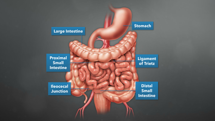 $1.67M Verdict: Animating How Mesenteric Ischemia Caused Abdominal