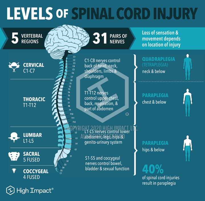 Infographics Break Down the Impact of Spinal Cord Injury (SCI) | High