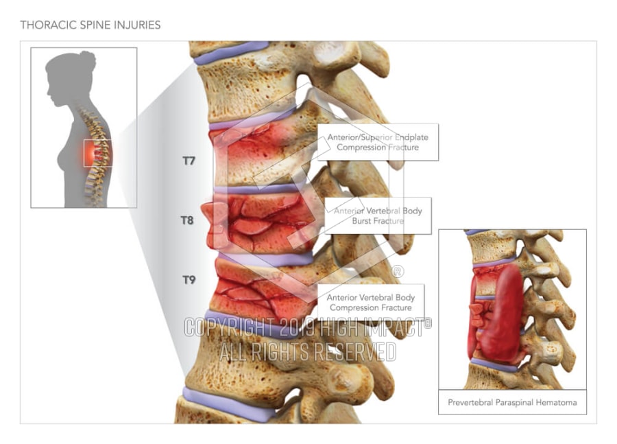 thoracic spine thoracic spine