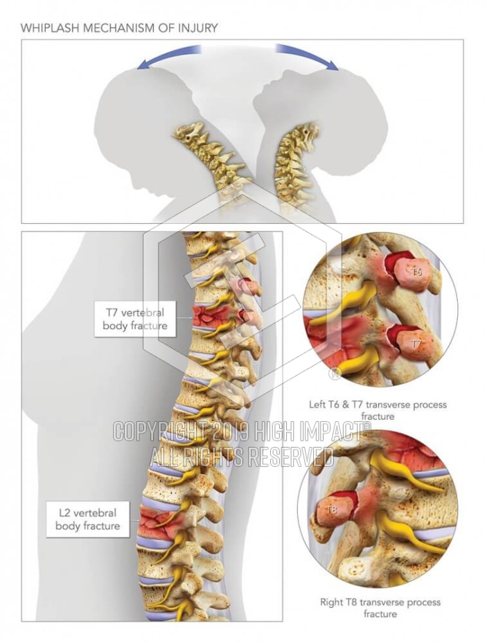 Neurontin for tooth pain
