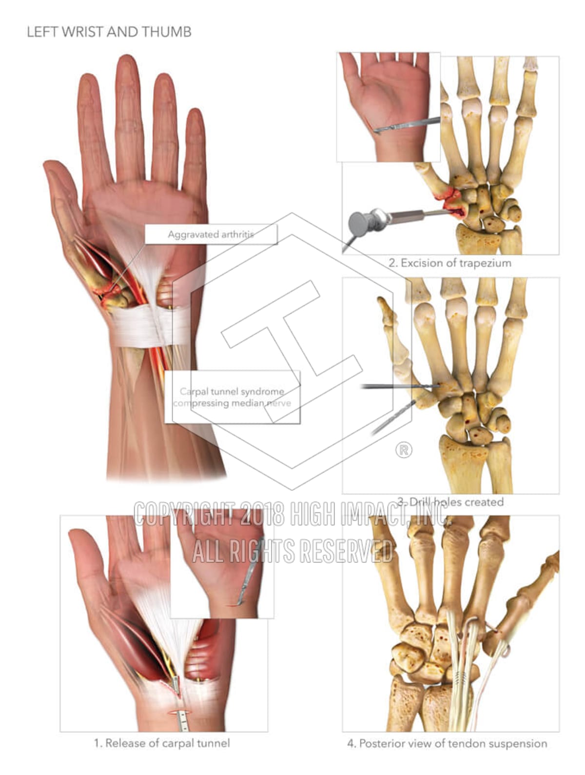 Anatomy Of The Thumb - Anatomy Drawing Diagram