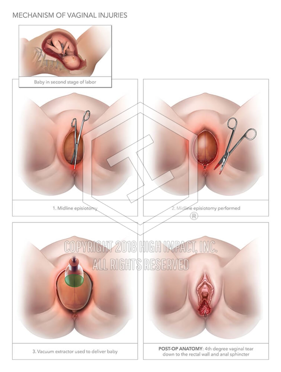 Pics of vaginal Congratulate, pics of vaginal for that