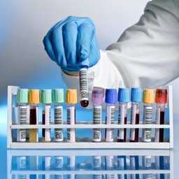 blood-samples-256x256